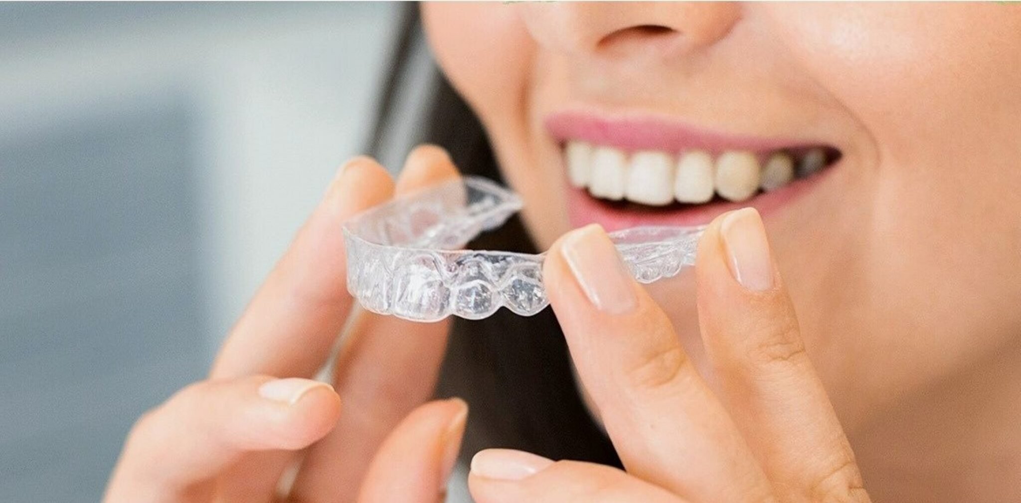 smiles orthodontics — photo 1